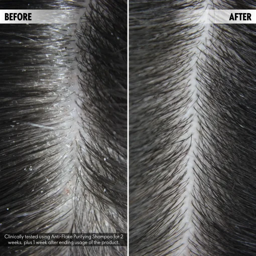 Anti-Flake Purifying Shampoo - Image 4